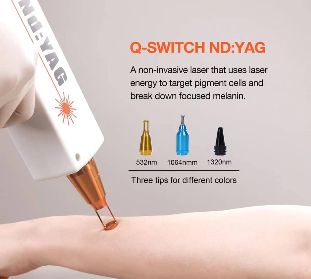 REMOVO™ Laser Handpieces