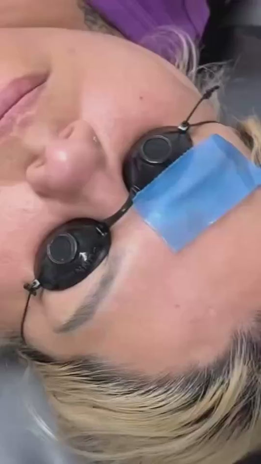 Skin Shield